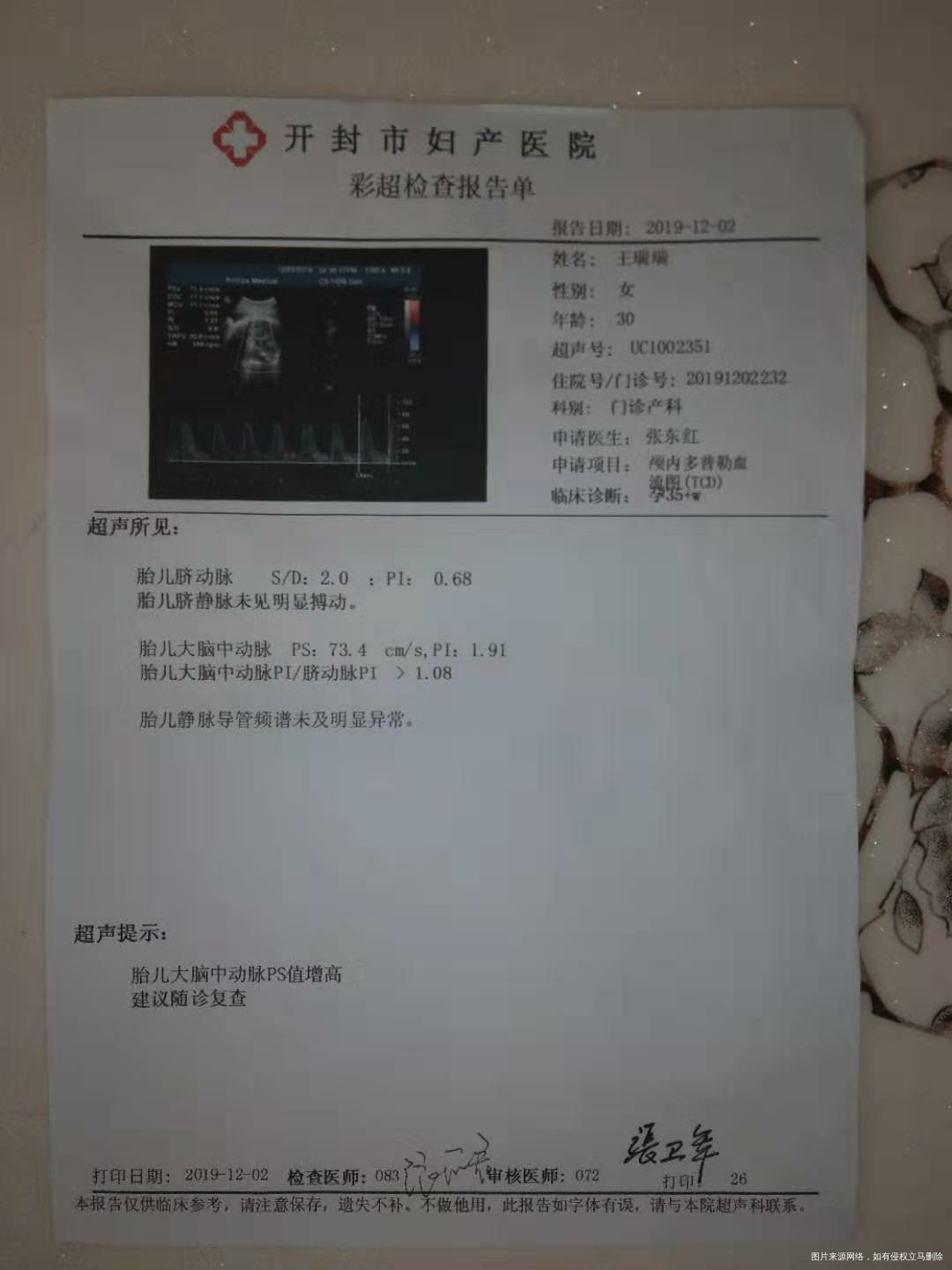 医生在吗 麻烦帮忙看一下