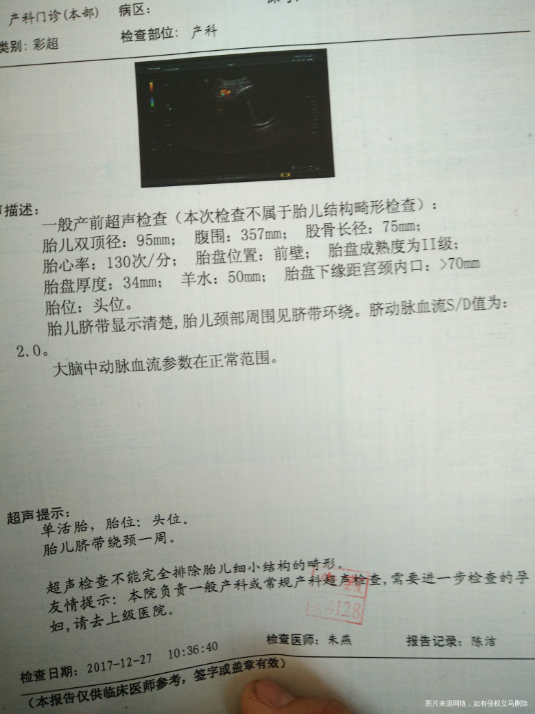 39+2 b超宝宝多重