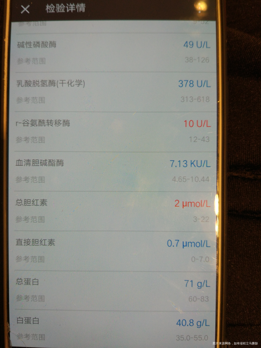 多囊卵巢综合征试管婴儿