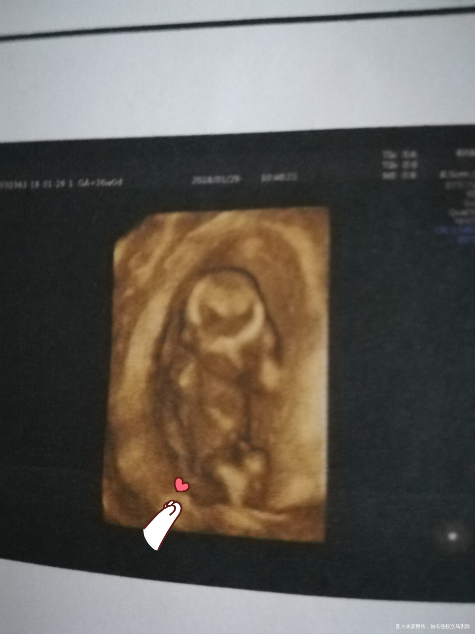 我怀啦 | 今天nt顺利通过啦,宝宝看起来很可爱。