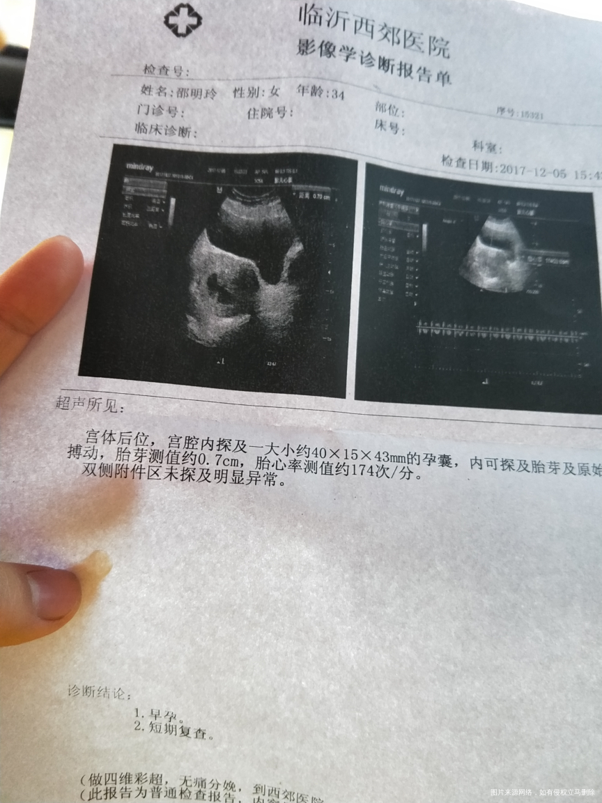 试管移植第三十八天宝宝胎心