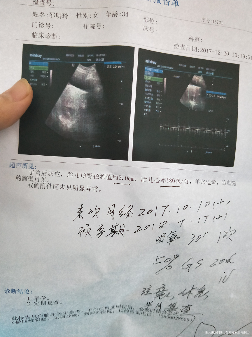 试管移植第五十天!宝宝心跳太快