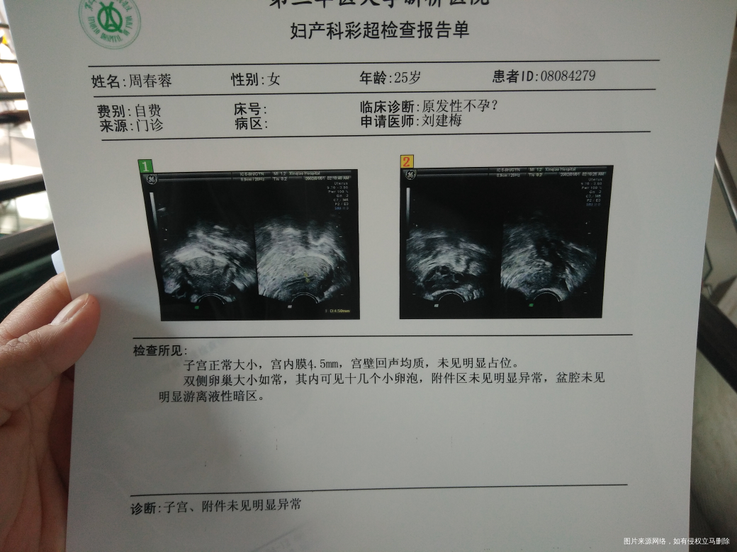 请医生帮忙看看结果!!!!这样的结果好吗?