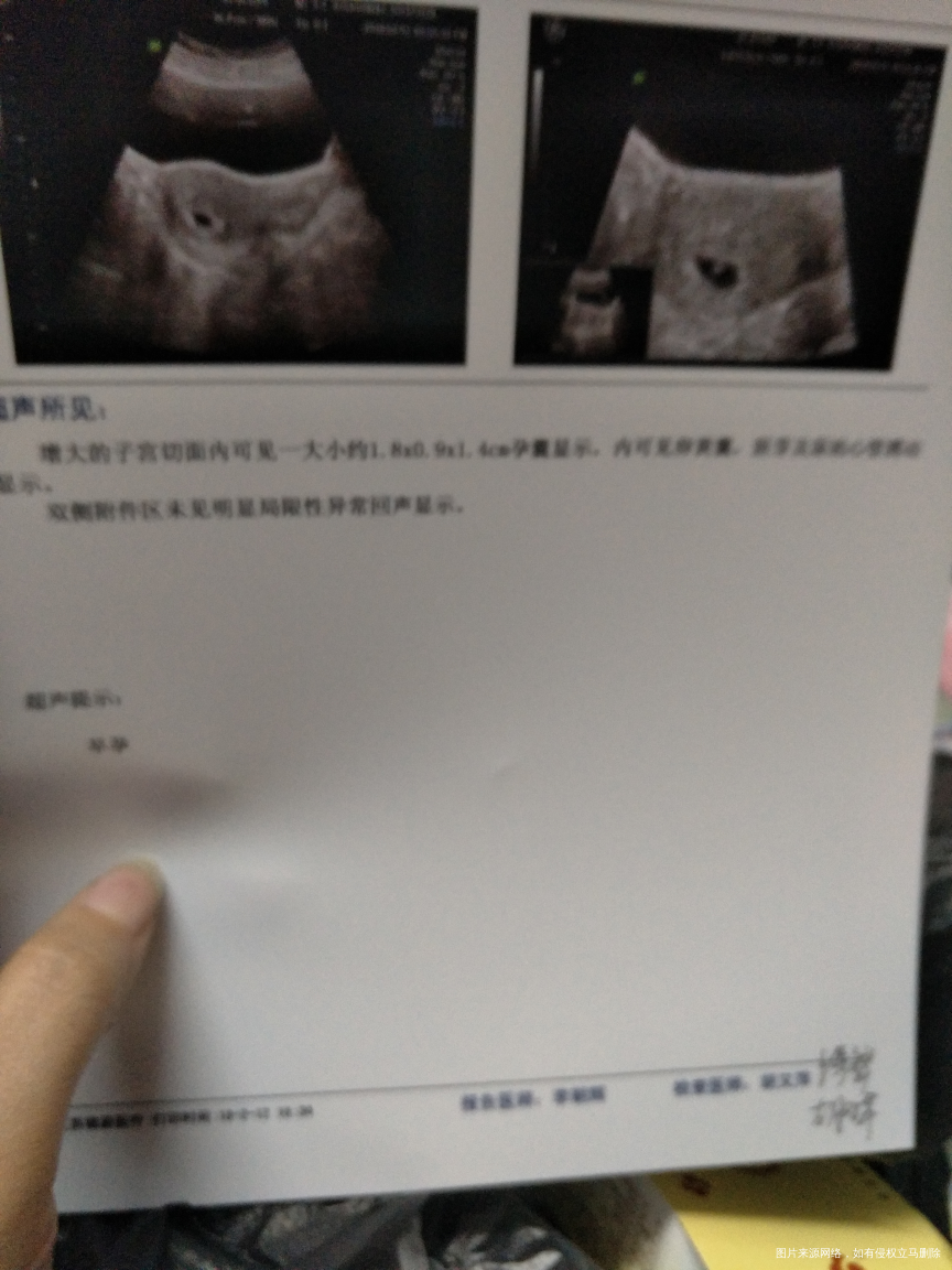 医生给看看今天刚做的b超