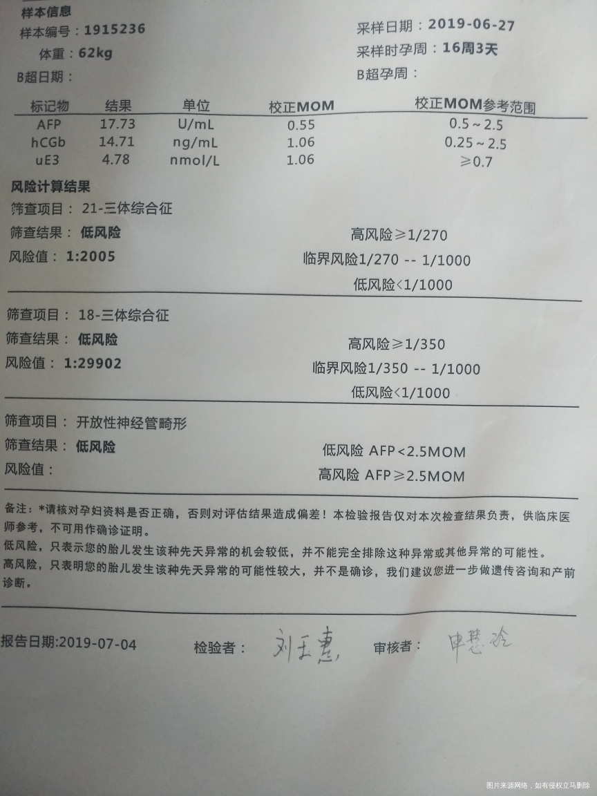 请医生给看下唐氏筛查的结果