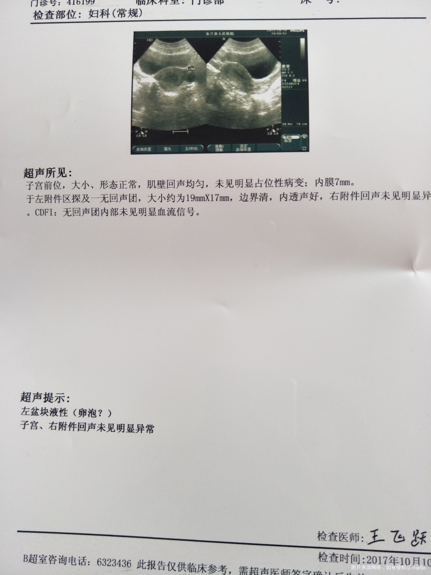 医生帮我看看b超子宫恢复的怎样