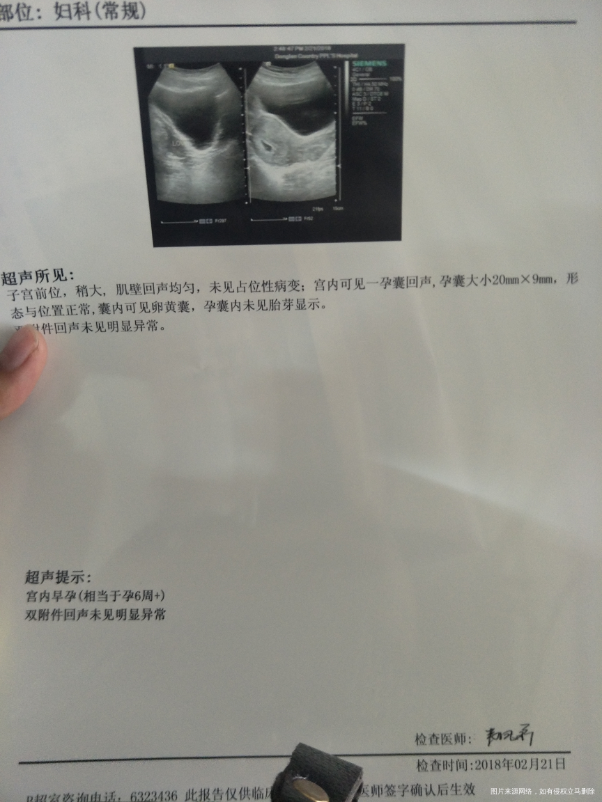 医生帮忙看看检查都正常不