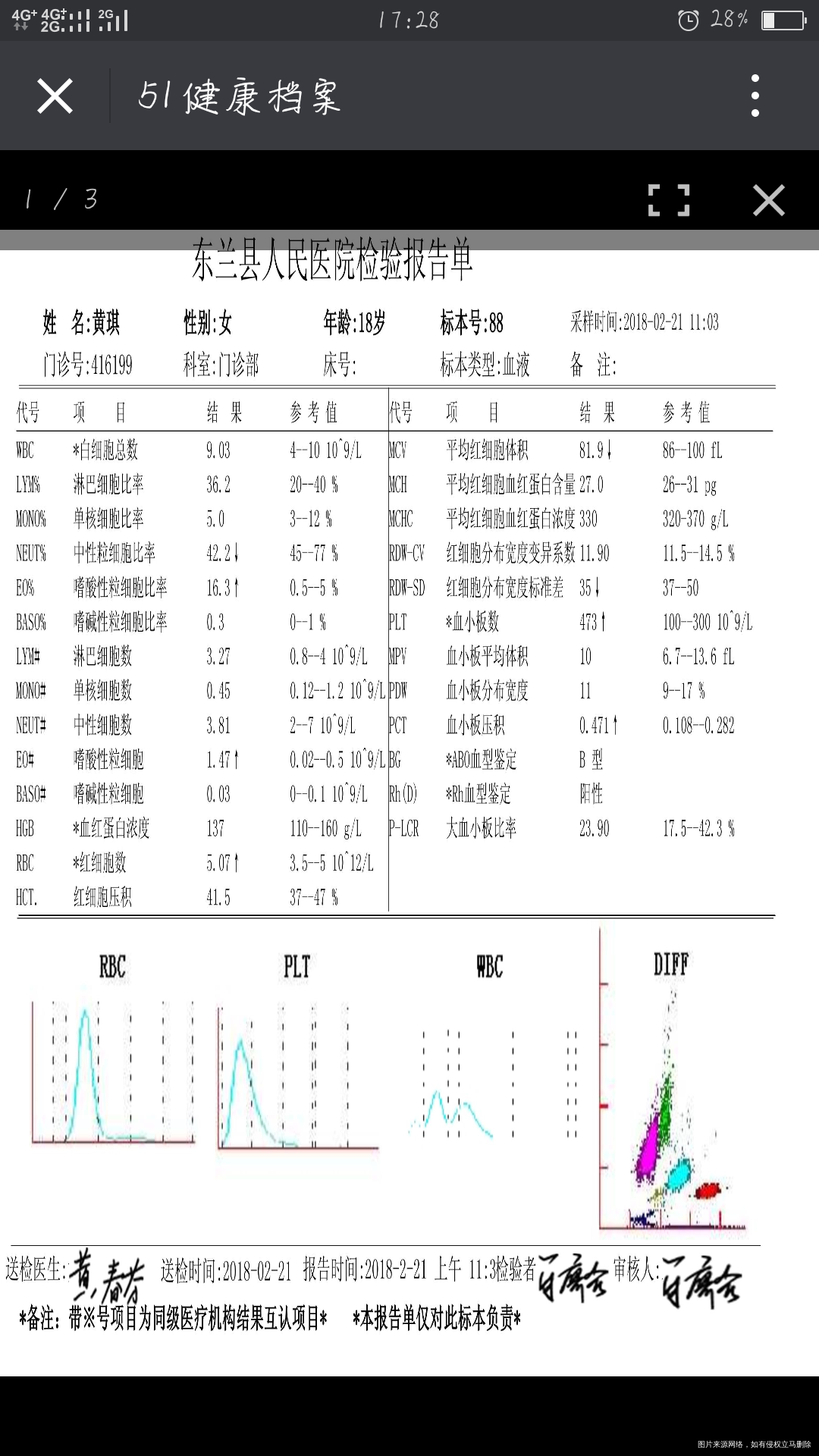 医生帮忙看看检查都正常不