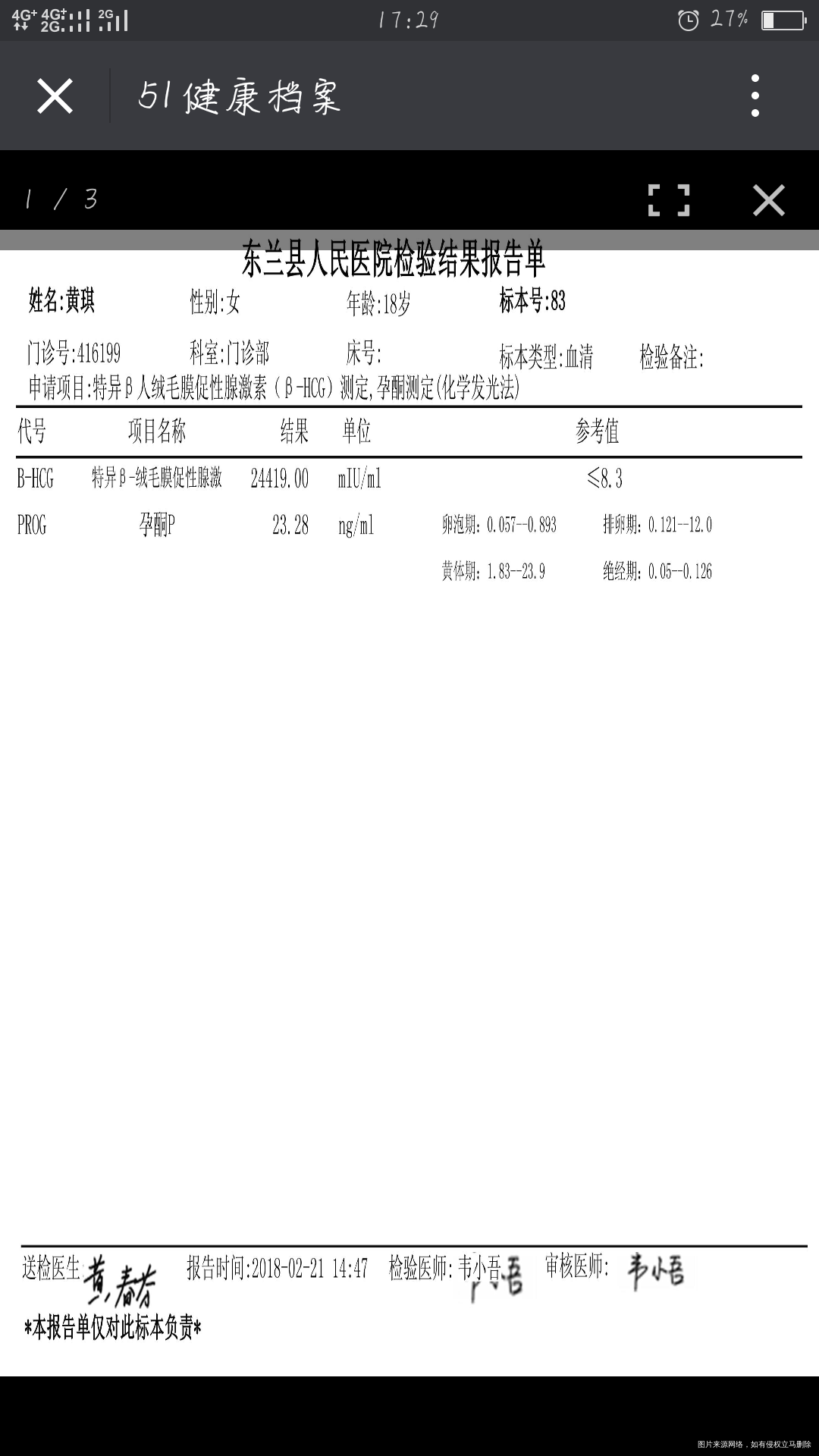 医生帮忙看看检查都正常不