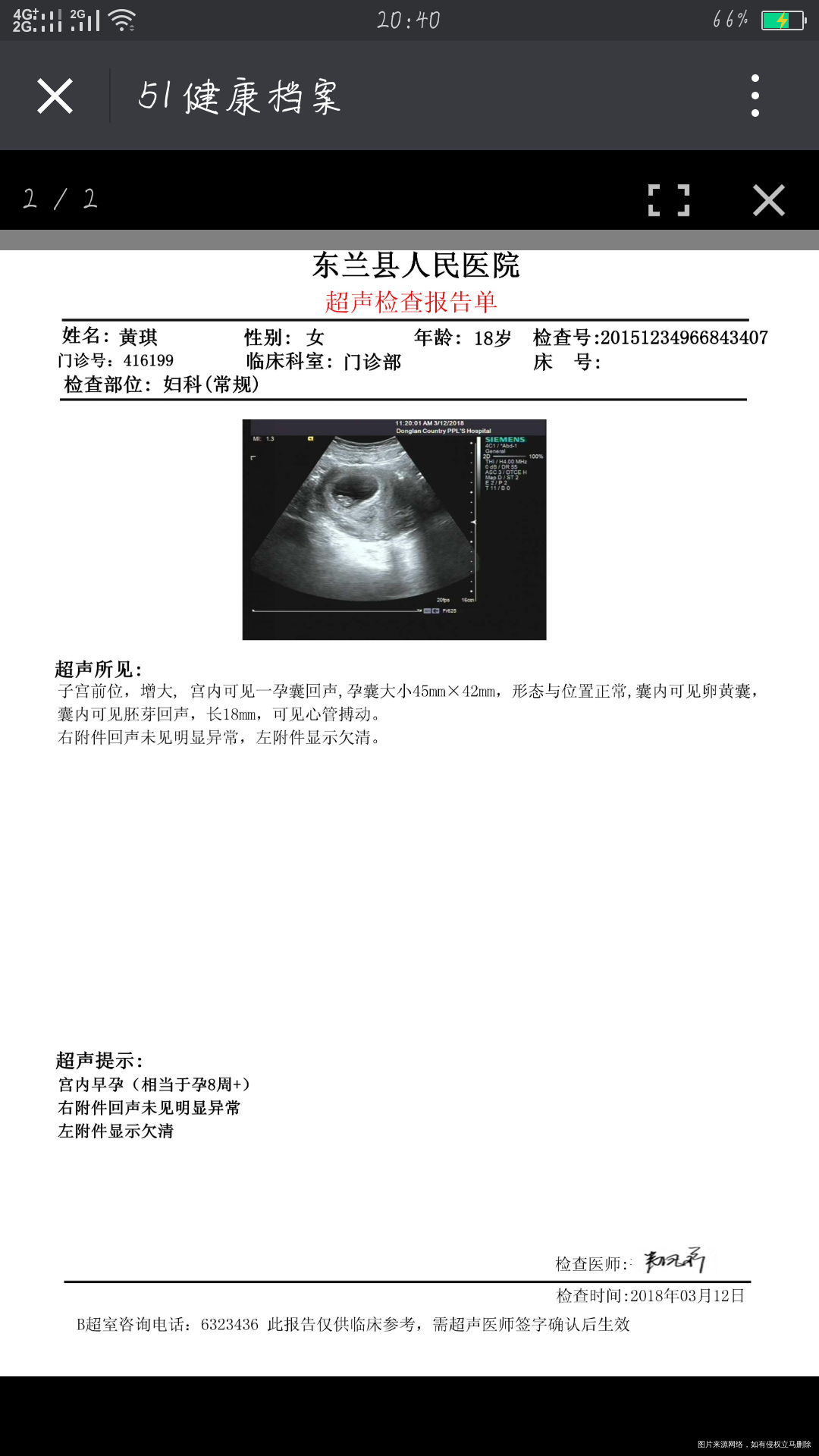 孕七周开始小腹就疼的挺频繁的