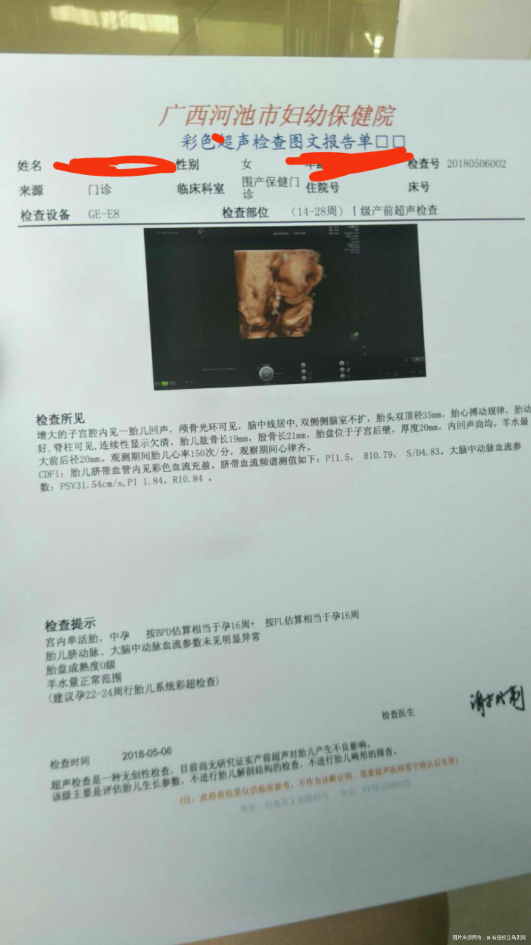 医生帮我看下这是16+几天