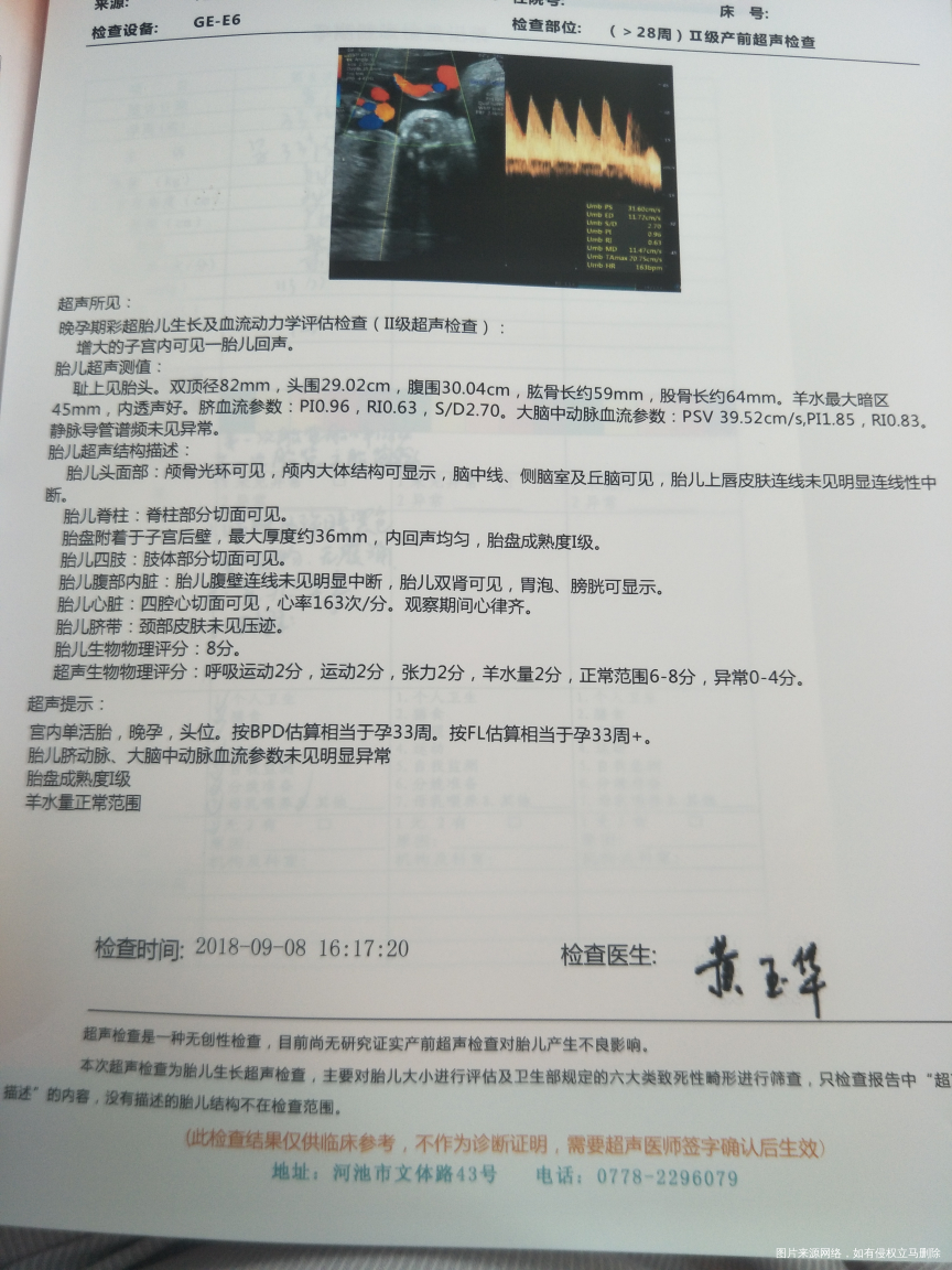 麻烦医生帮我估算下胎儿有多重