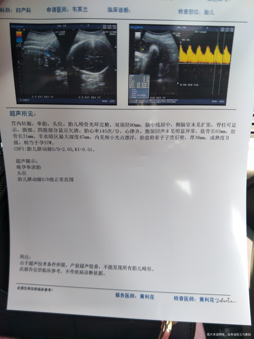 羊水内见有细小光点漂浮