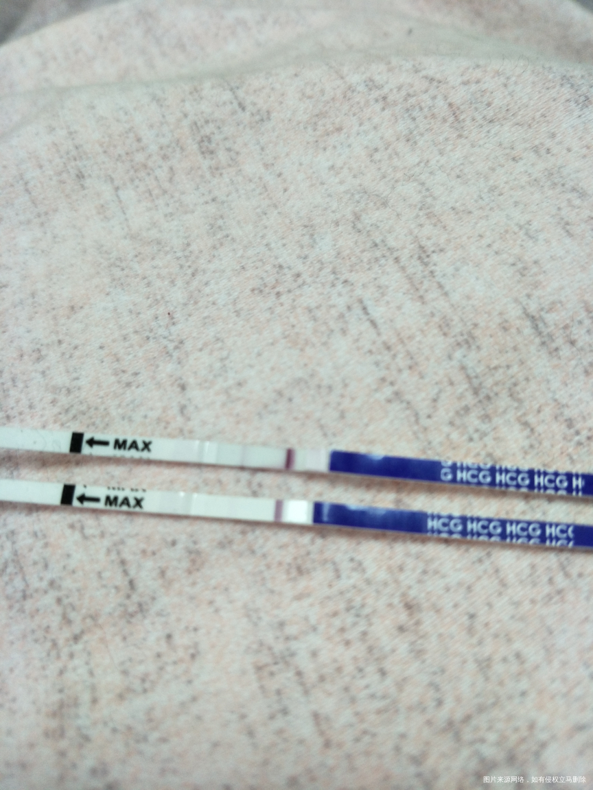 刚刚忘记附上图了28号移植的