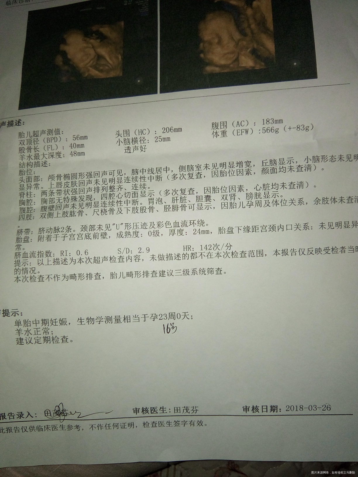 麻烦在线医生帮我看看,在线等