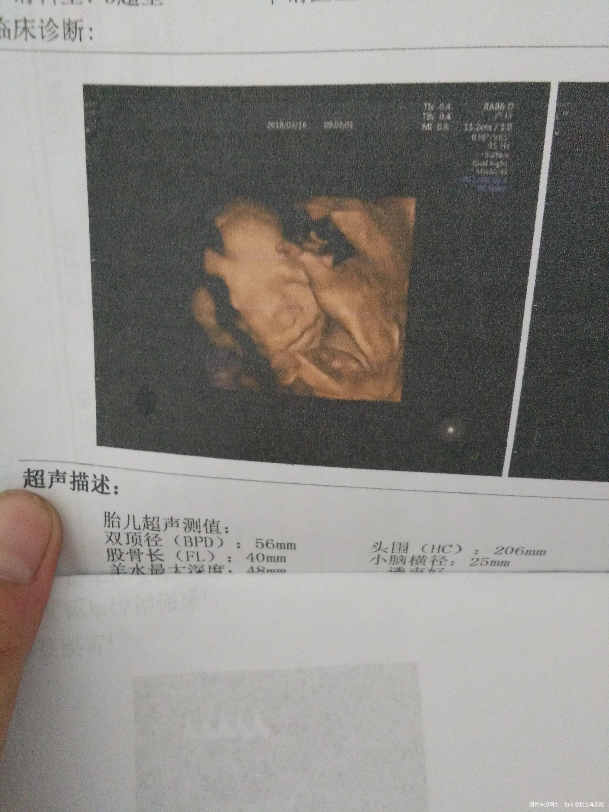 有些姐妹说宝宝四维彩超