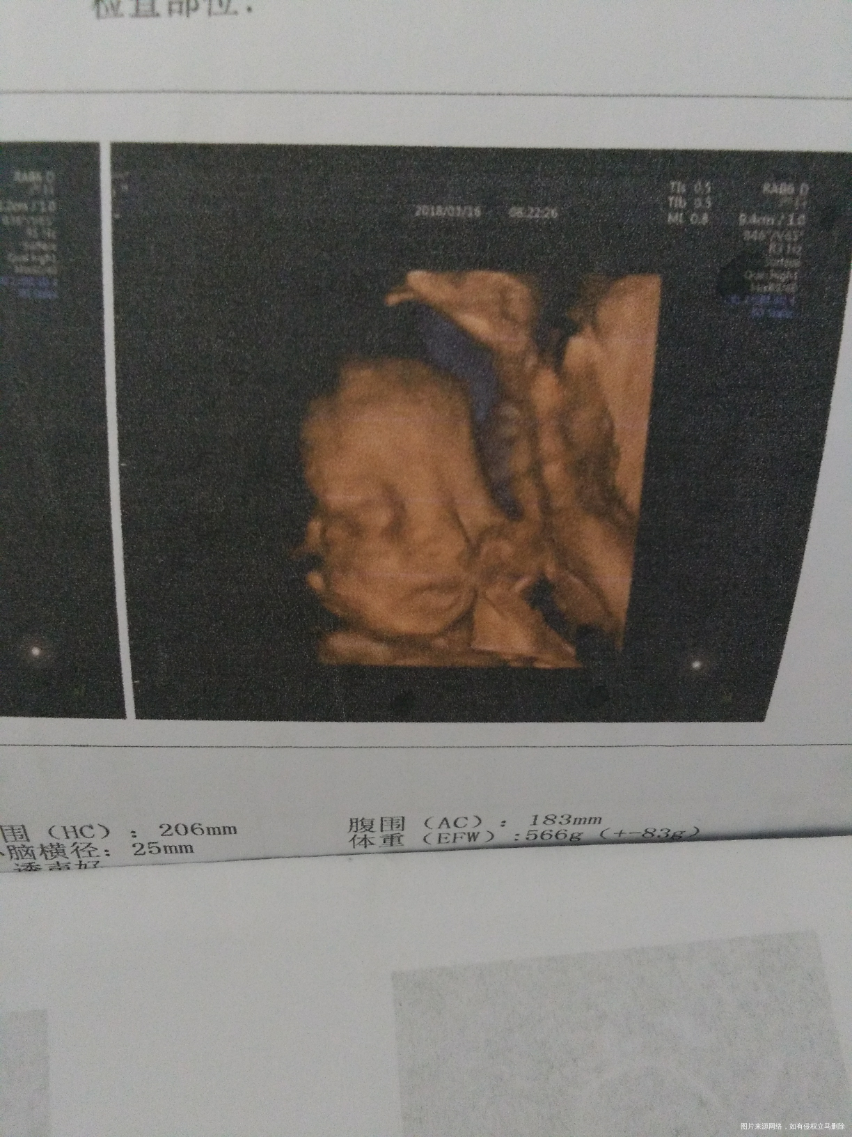 有些姐妹说宝宝四维彩超