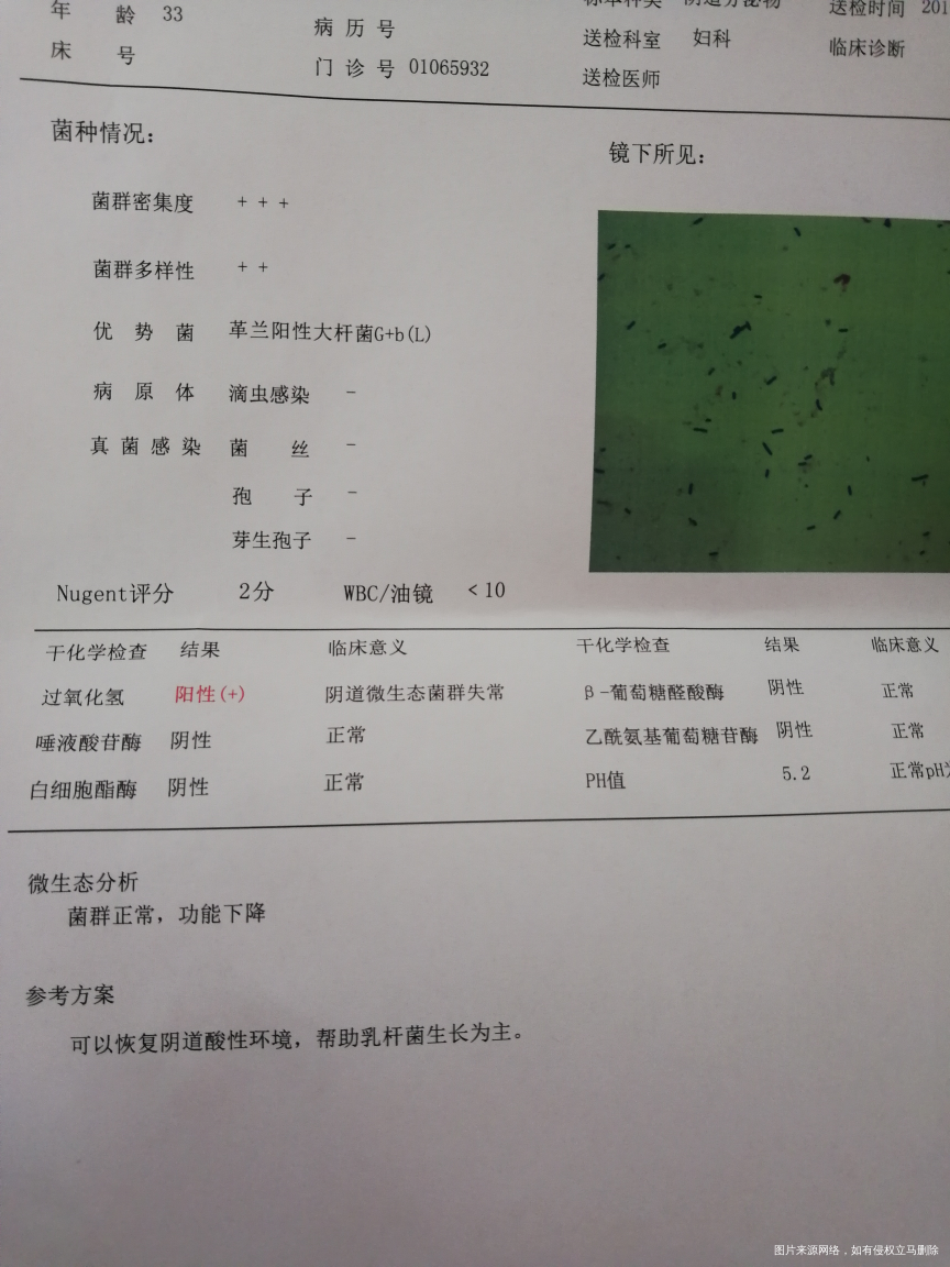 在线求助医生,分泌物检查结果