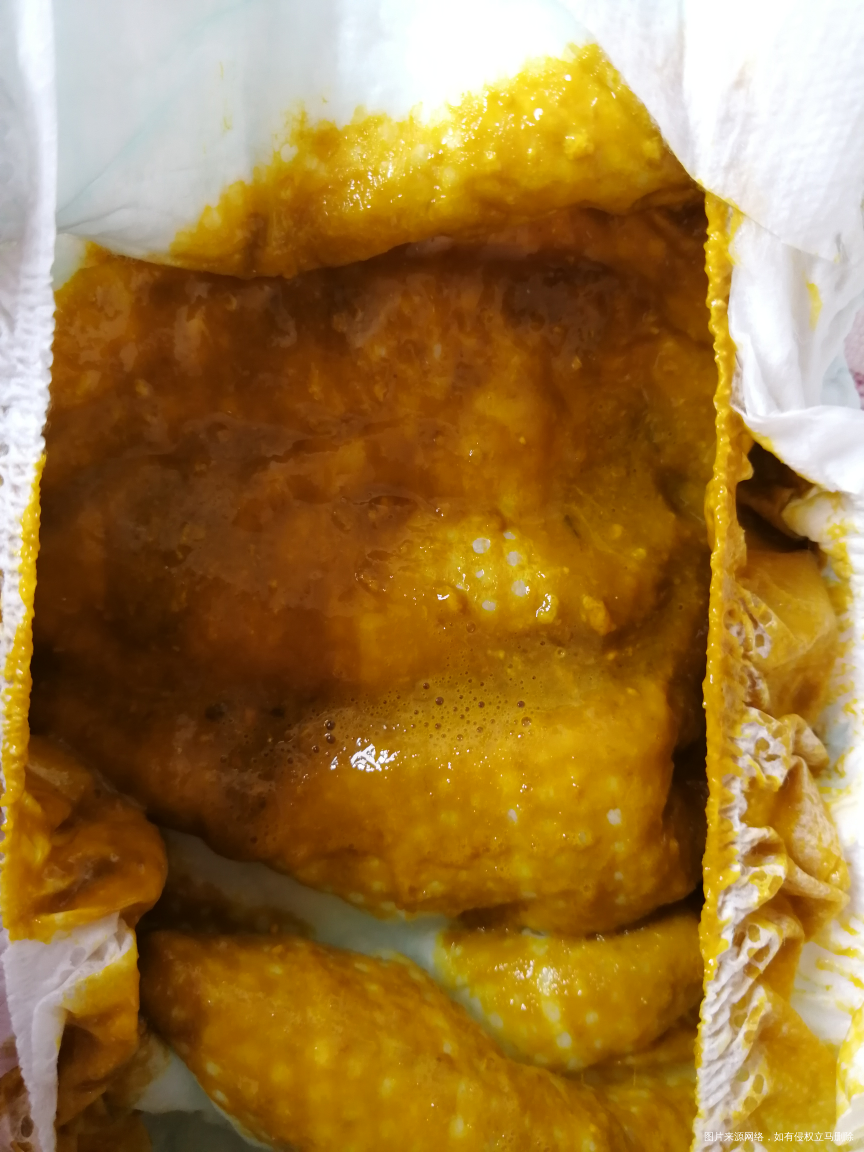 宝宝七十多天,今天大便这样,是消化不良还是着凉