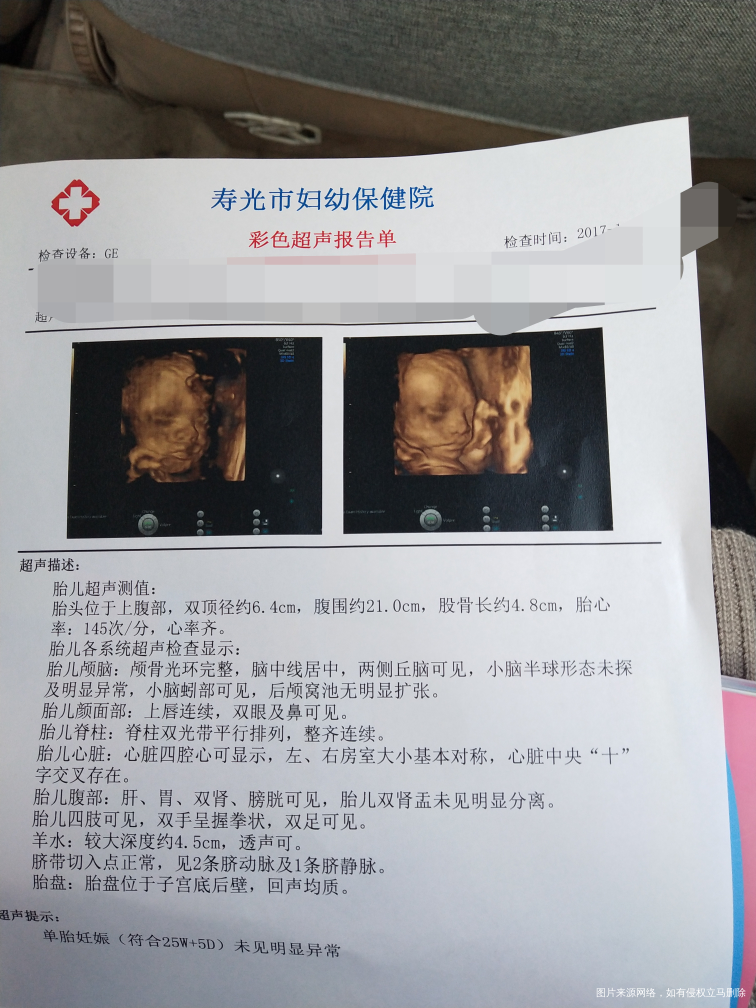 四维还算顺利,照了两遍成功了