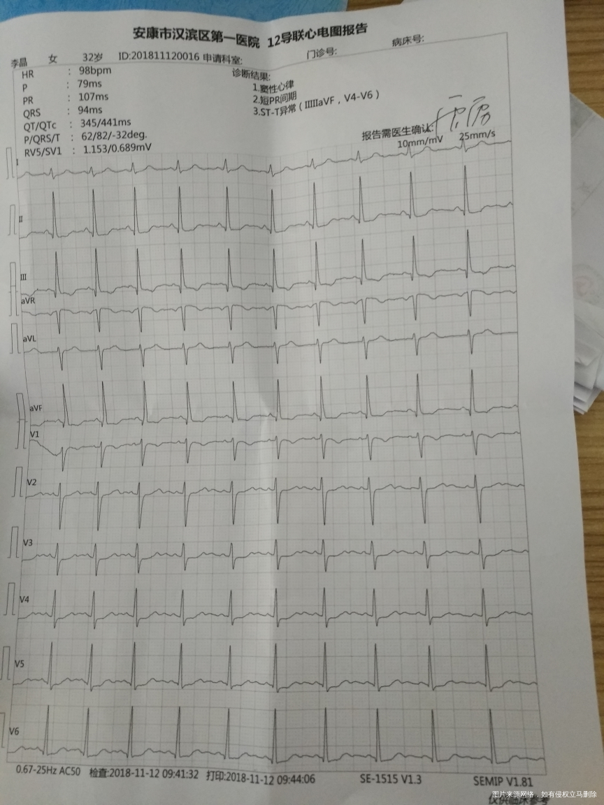 今天去做了产检,NT值是1.7
心电图室是3个…
