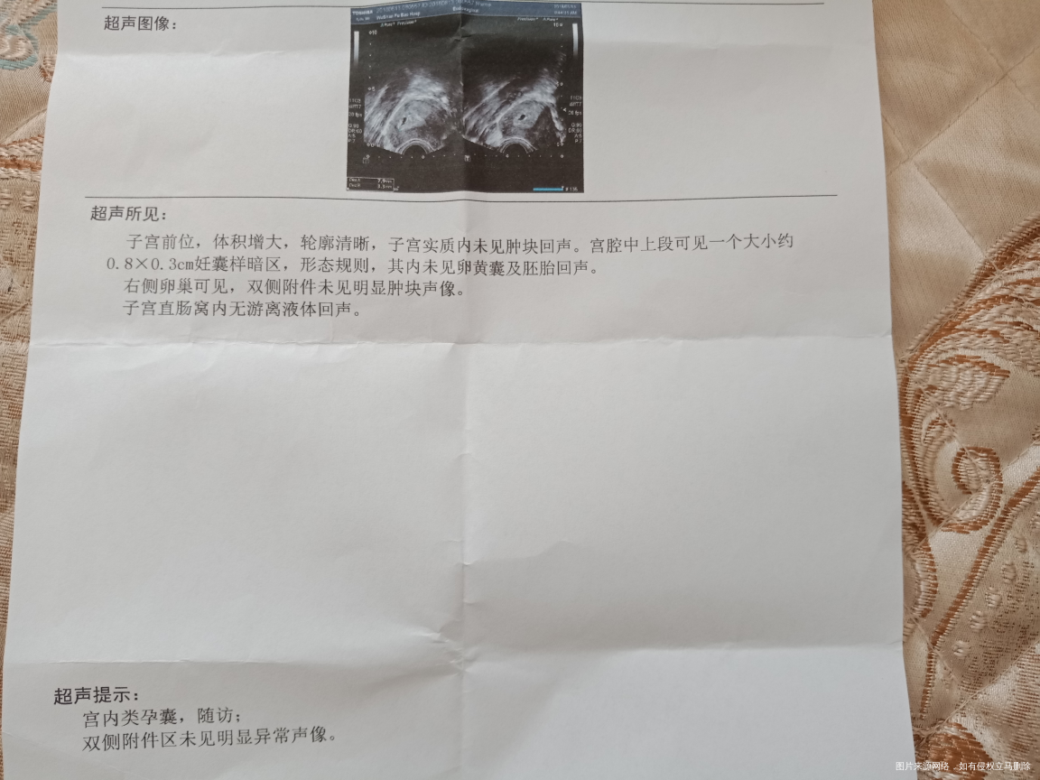 孕六周胸不胀了变软了正常吗?