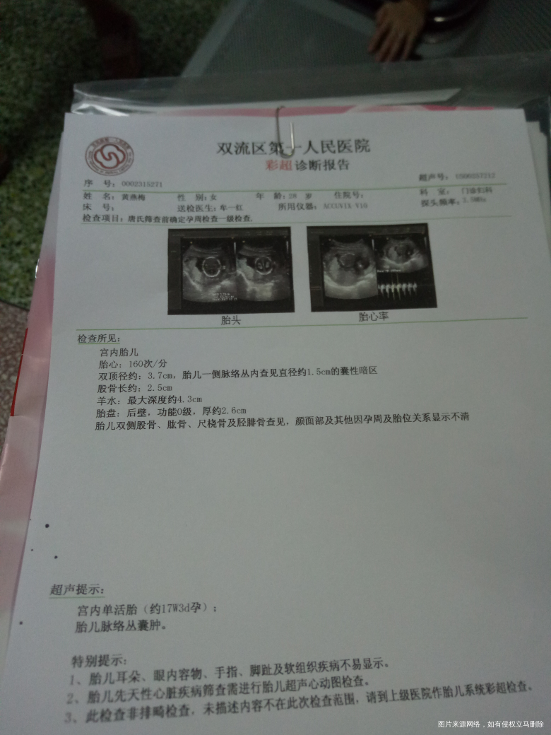 请你们帮我看一下这彩超结果,谢谢