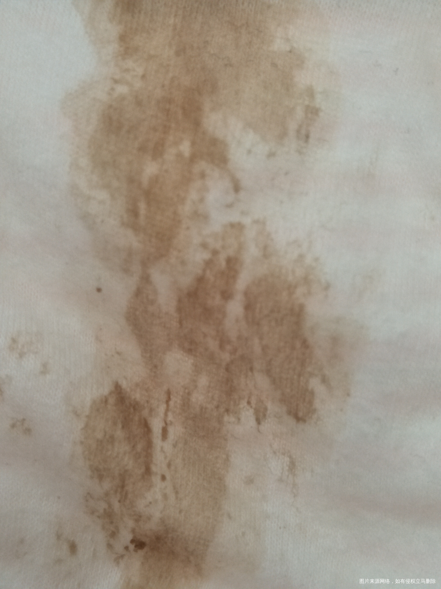 刚上厕所发现内裤大片黄色,不知道是出血还是什么原因?之前有过一次因为没什么反应就...