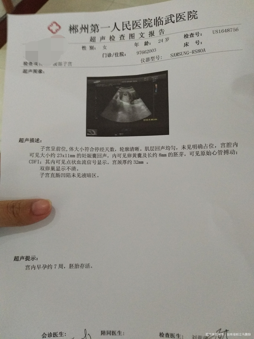 今天去复查了,麻烦医生帮忙分析一下