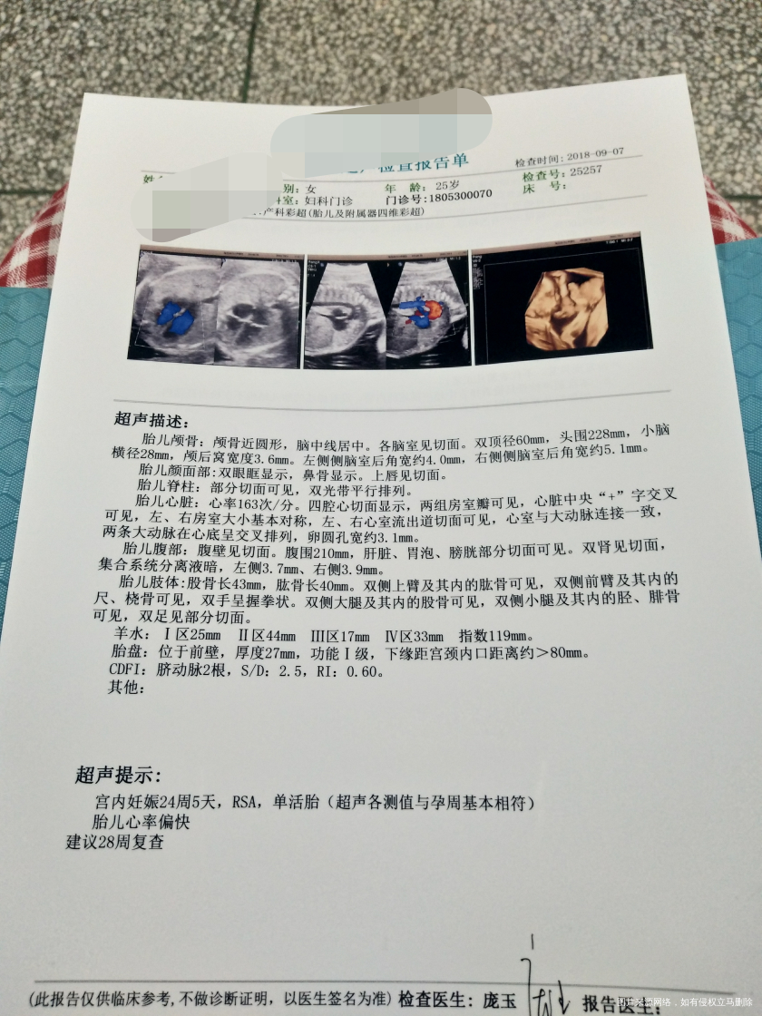 麻烦医生帮忙看看四维彩超结果单