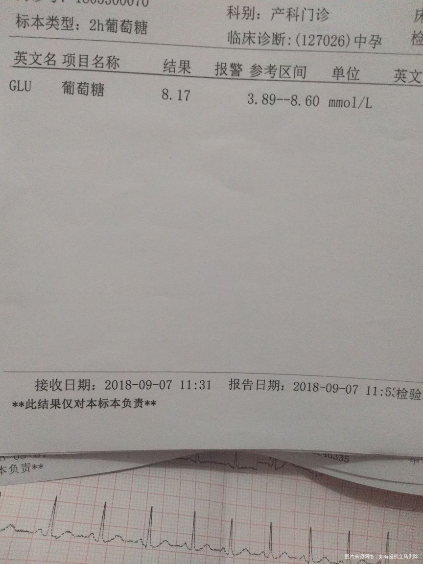 麻烦医生帮忙看看四维彩超结果单