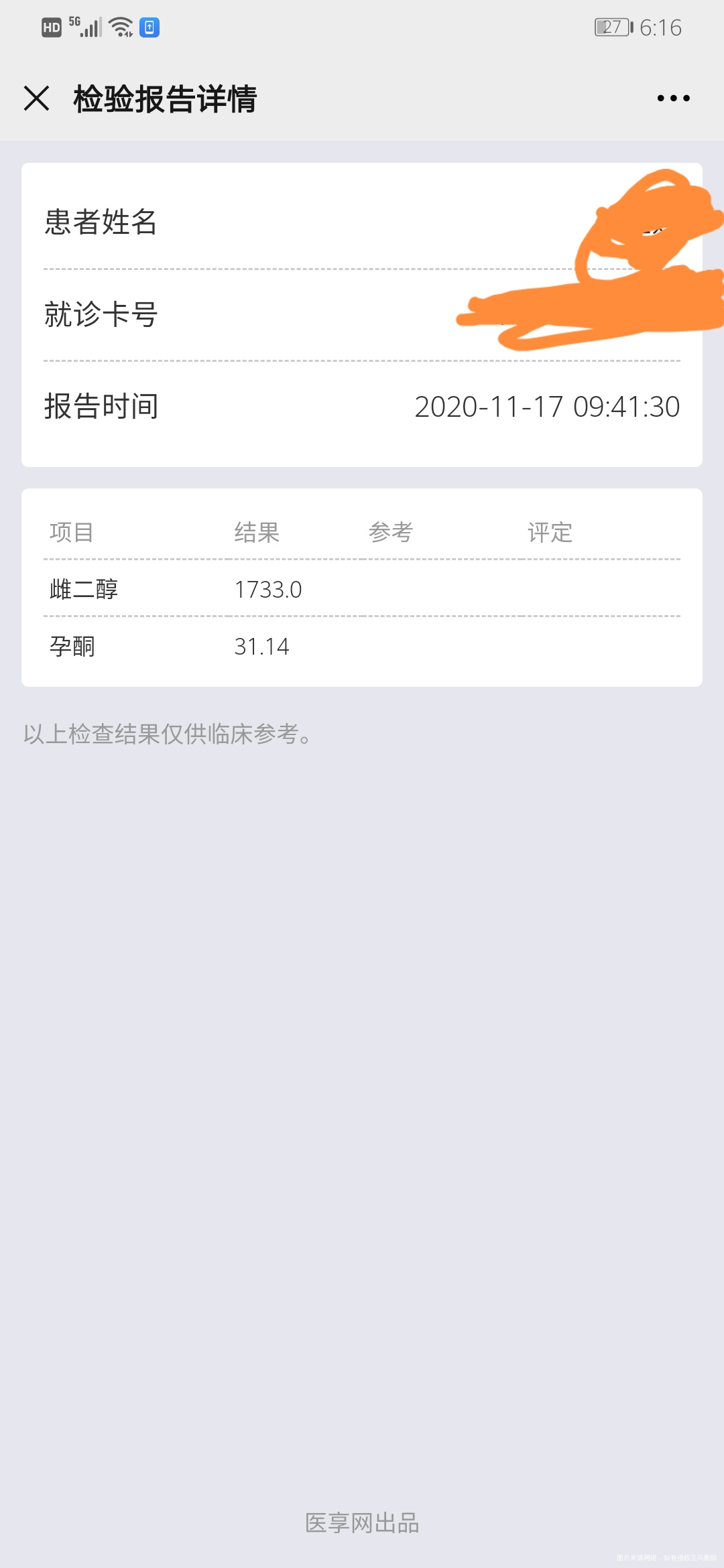 移植第六天雌二醇1733.孕酮31,这个数值不知道胚胎着床了没