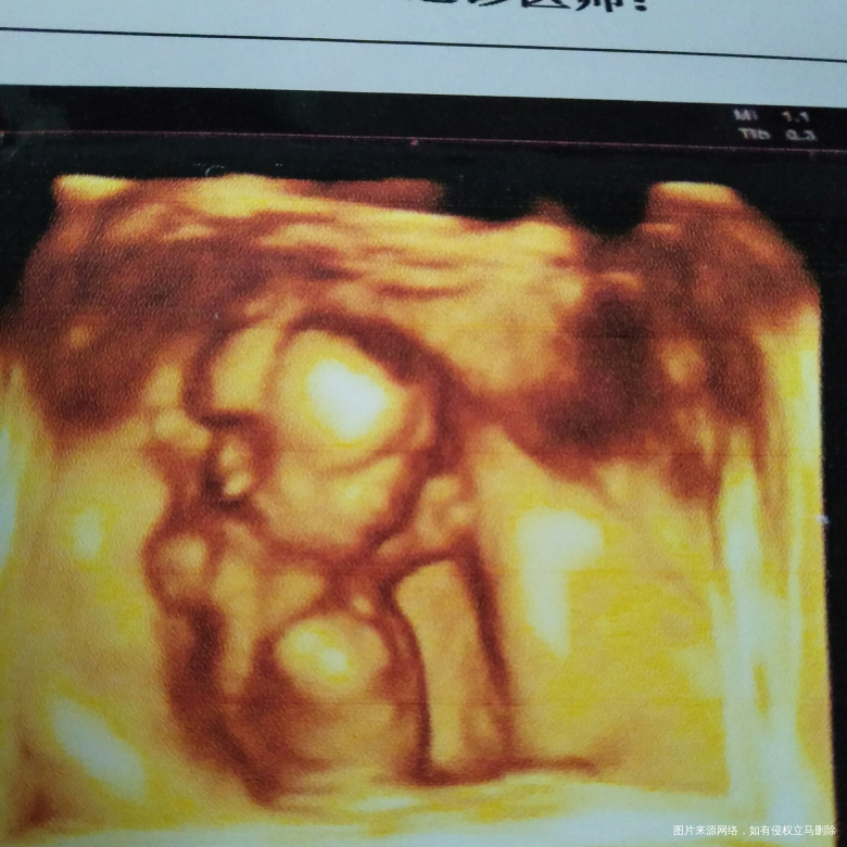 我怀啦 | 现在18周加5天,宝妈们看看(⊙o⊙)哦