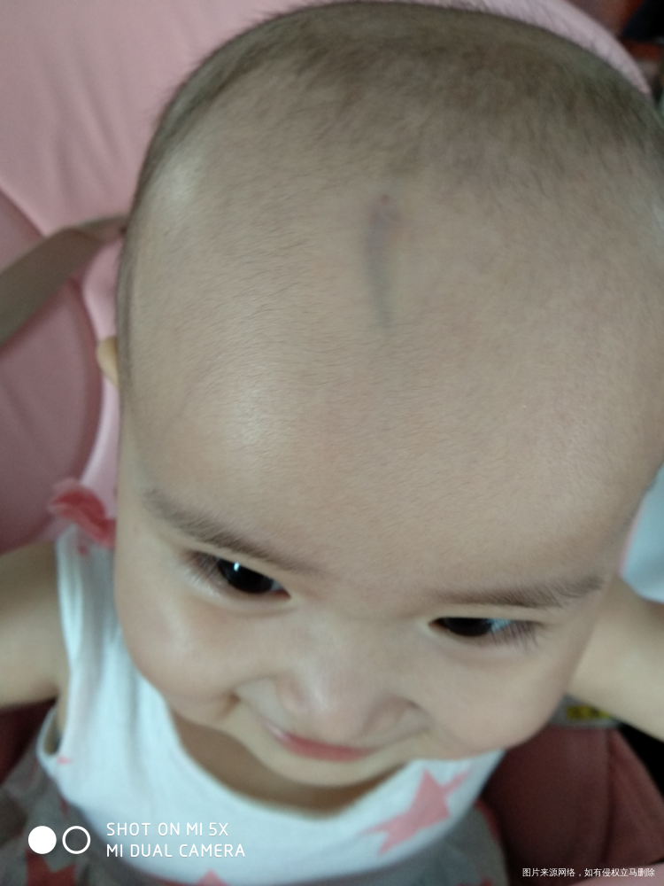 医生建议去复查,但我不想查了