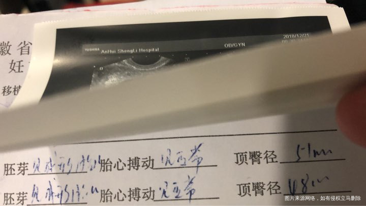 二超顺利通过,希望大家都能好孕