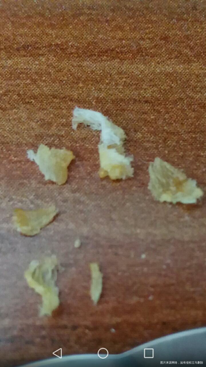 【育儿心得】到底要不要给宝宝掏耳朵