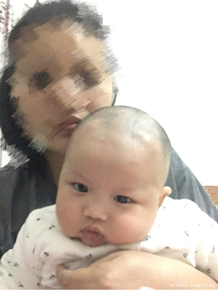 宝宝还有几天就五个月了,但宝宝脖子总歪向右边。