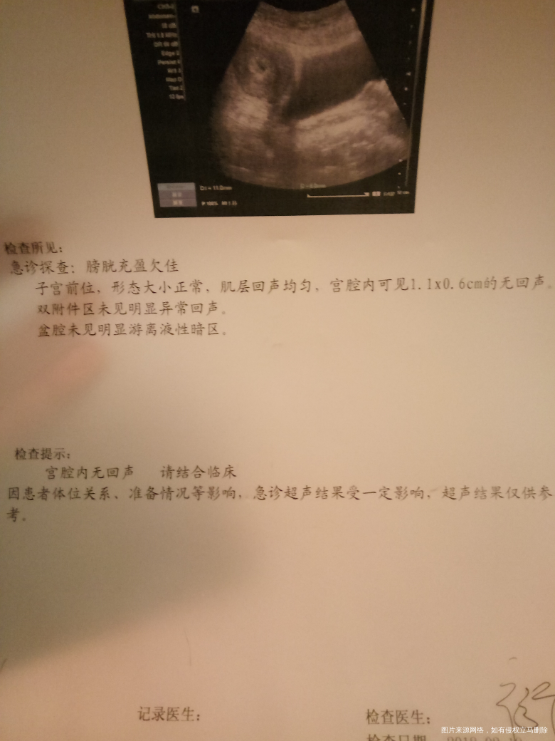 有知道怎么回事的吗姐妹们