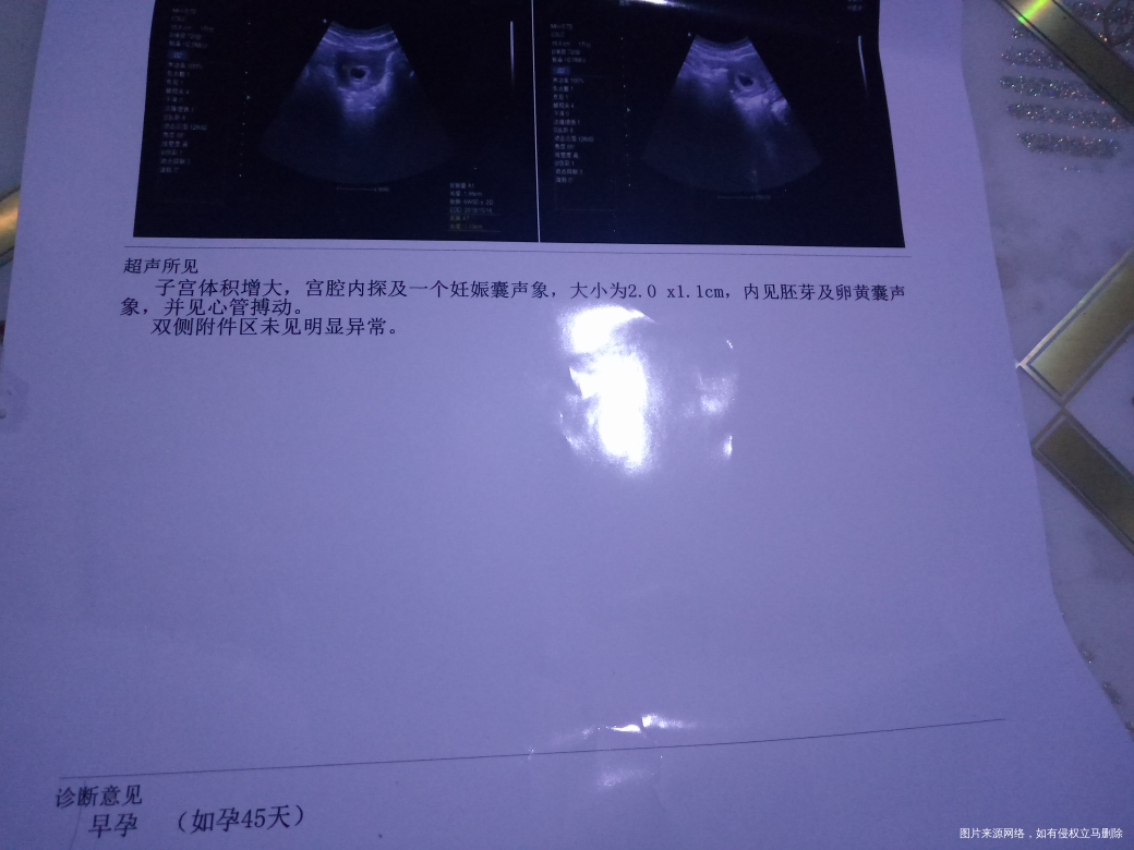 医生帮我看看,这次结果的