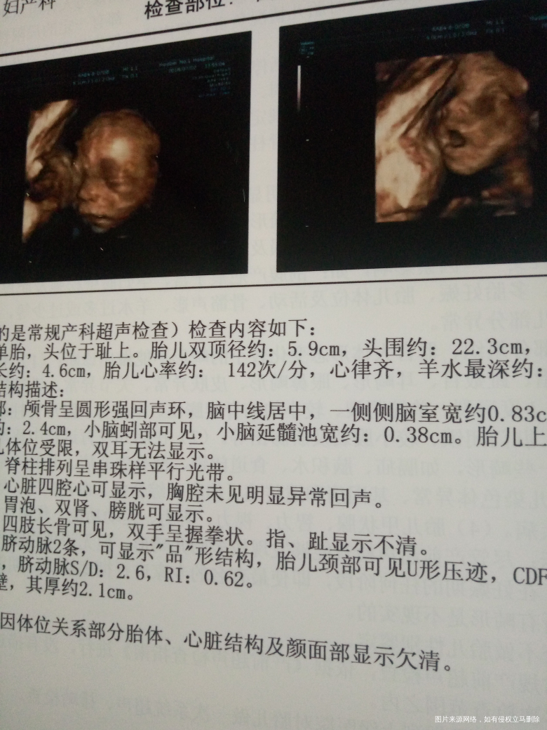 从四维可以看出是不是有缺陷吗??