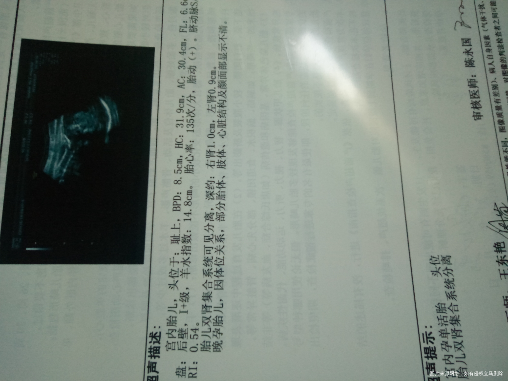 孕34+2,今天的彩超帮忙看