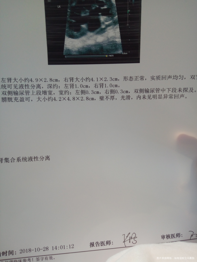 宝宝出生26天了,今天查出