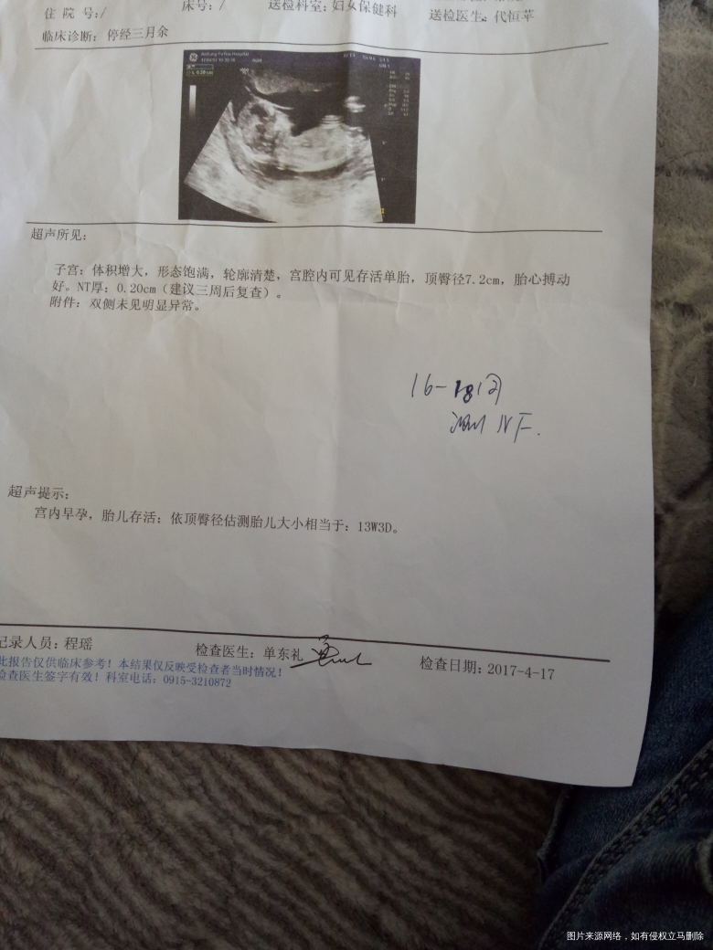 医生帮忙看看NT厚0.20cm是不是不好啊