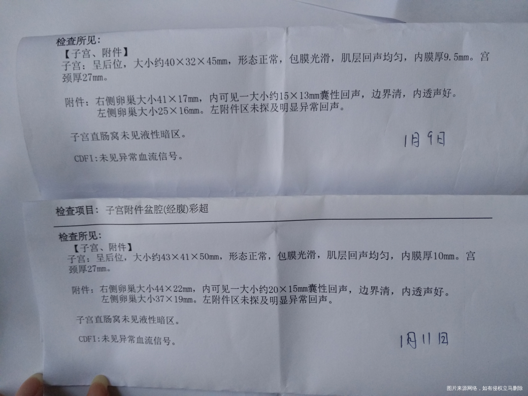 隔一天又去查的彩超卵泡怎么样