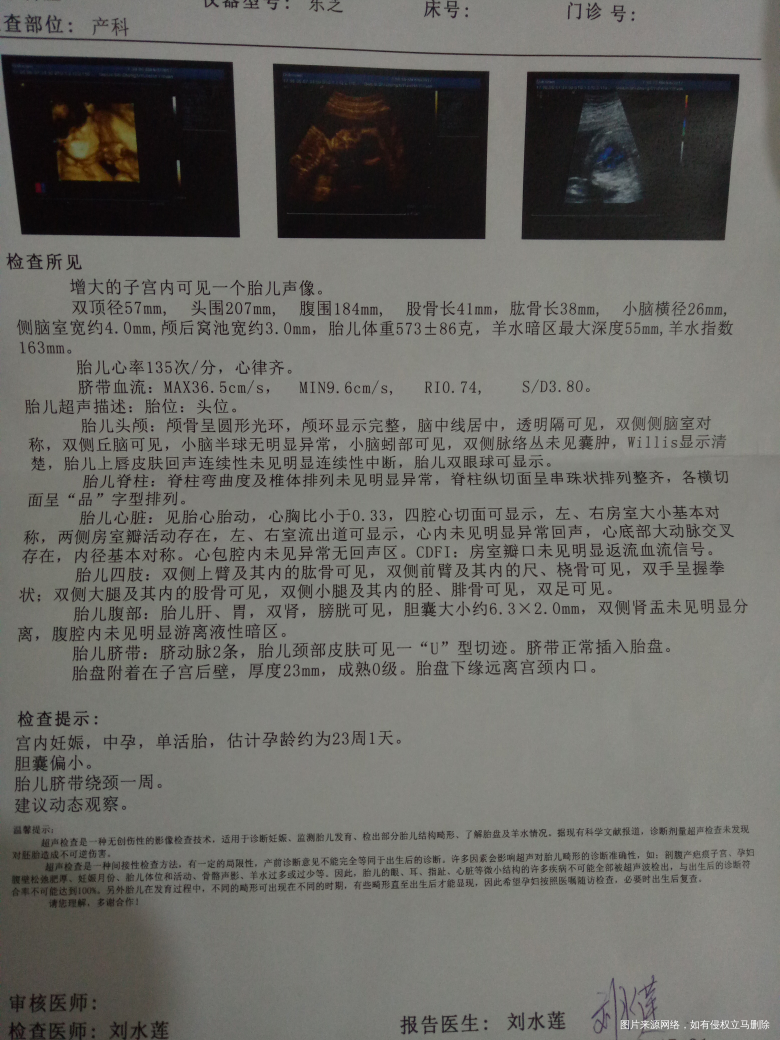 帮我看下三维结果,这样的问题怎么办呢?