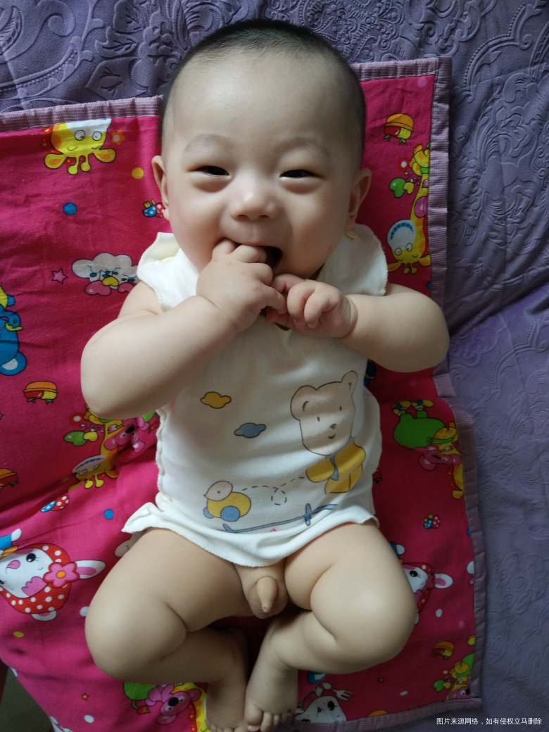 包皮过长?请大夫帮忙看看