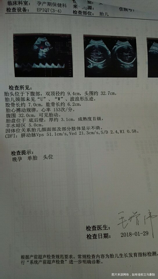 求助医生,帮我看看这是今天刚做的BC单跟胎心监护
