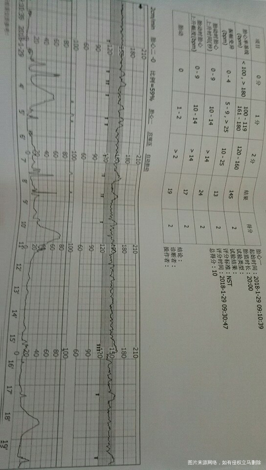 求助医生,帮我看看这是今天刚做的BC单跟胎心监护