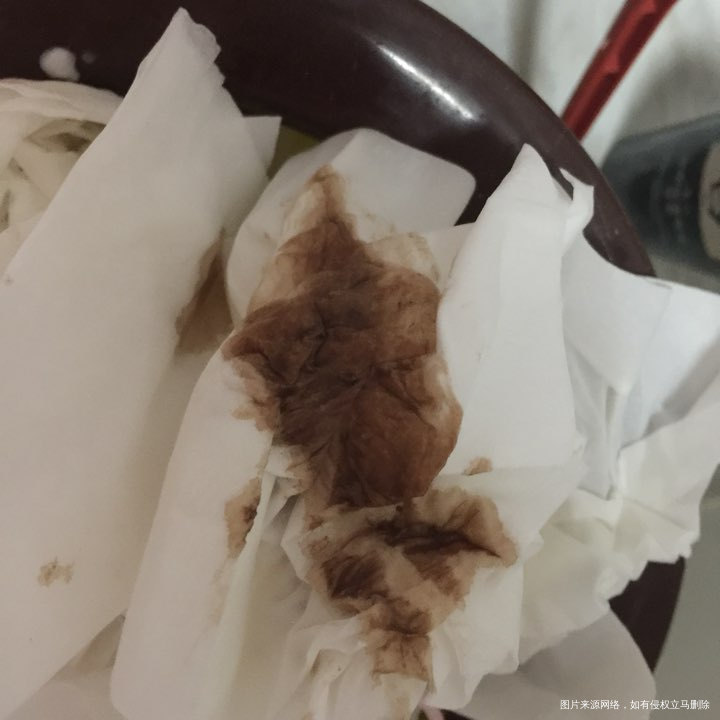 移植第25天出现大量褐色分泌物