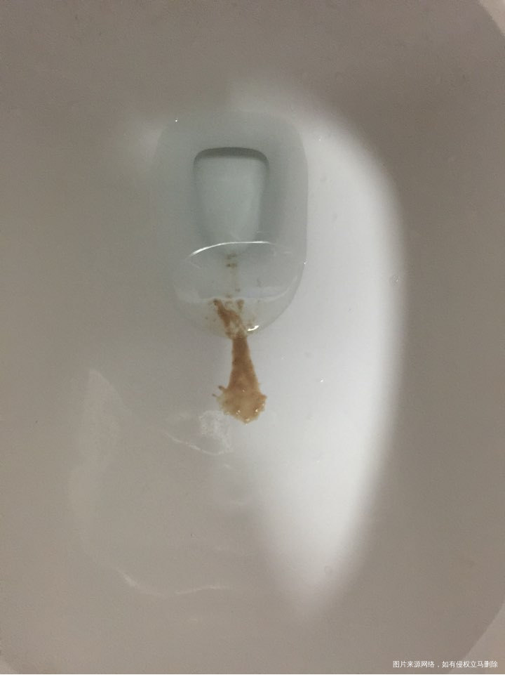 移植25天后流咖隔三差五的